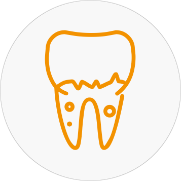 Endodonzia